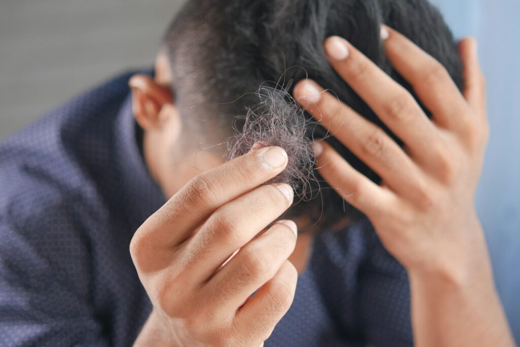 Supplements Cause Hair Loss